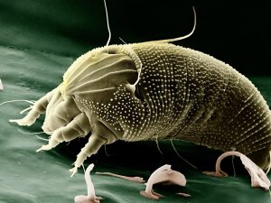 Mengenal Scabies, Penyakit Kulit yang Kerap Menyerang Santri