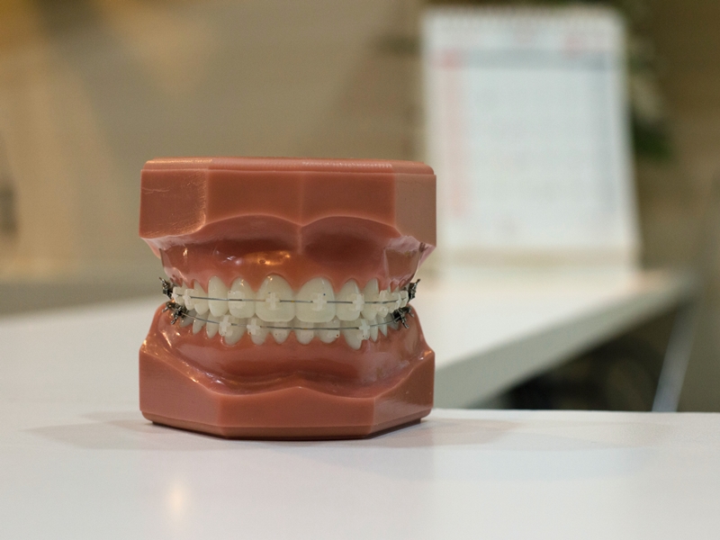 Pengalaman Pakai Bionator: Nasib Punya Gigi yang Nggak Rapi dan Langganan Sakit terminal mojok.co