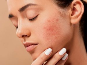 Nggak Usah Sok-sokan Pakai 10 Step Korean Skincare Routine kalau CTMP Aja Belum Khatam!