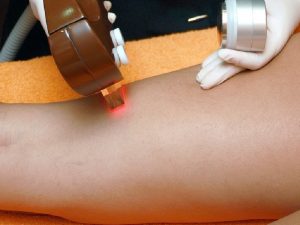 Mengintip Rahasia Mulusnya Badan Idol Korea yang Tanpa Bulu