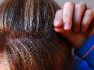 Derita Punya Rambut Beruban sejak Usia Muda