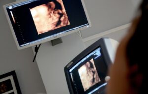 Orang-orang Harus Tahu Pemeriksaan USG Bukan Cuma untuk Ibu Hamil