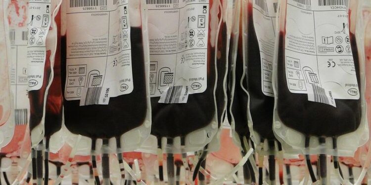 Boleh Nggak sih Kita Donor Darah Saat Puasa?