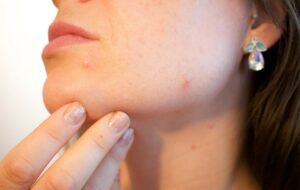 5 Penyebab Kulit Wajah Tetap Bermasalah meski Sudah Rajin Pakai Skincare