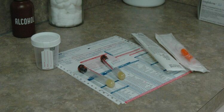 SKBN, Surat Tanda Bebas Zat Terlarang yang Bikin Pekerja Pusing Plus Kantongnya Jadi Kering skck