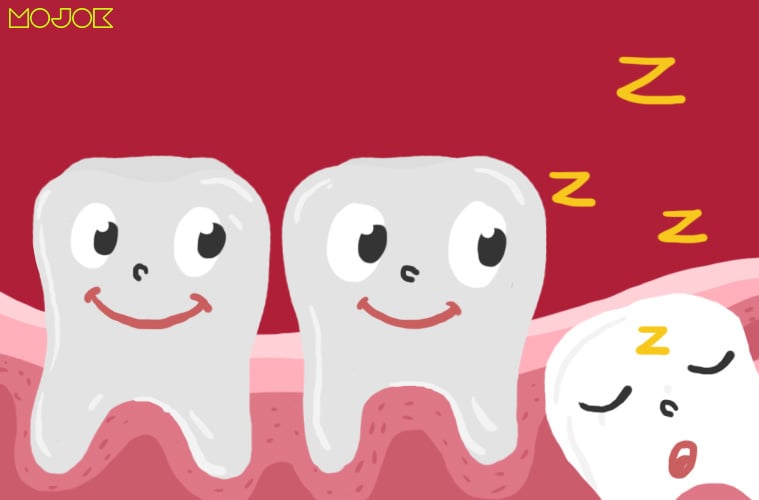 impaksi gigi geraham bungsu geraham dewasa infeksi operasi gigi tumbuh tidak wajar obat nyeri impaksi rahang kecil infeksi gusi perikoronitis mojok.co