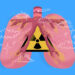 Benarkah Radiasi Paru-Paru Perokok Lebih Radioaktif daripada Chernobyl dan Fukushima? MOJOK.CO