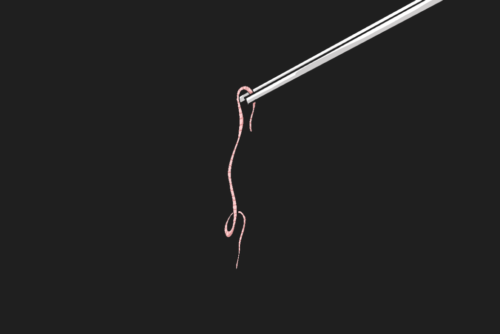 Raya, bocah asal Sukabumi yang meninggal karena cacing gelang. Sempat ditolong rumah teduh. MOJOK.CO