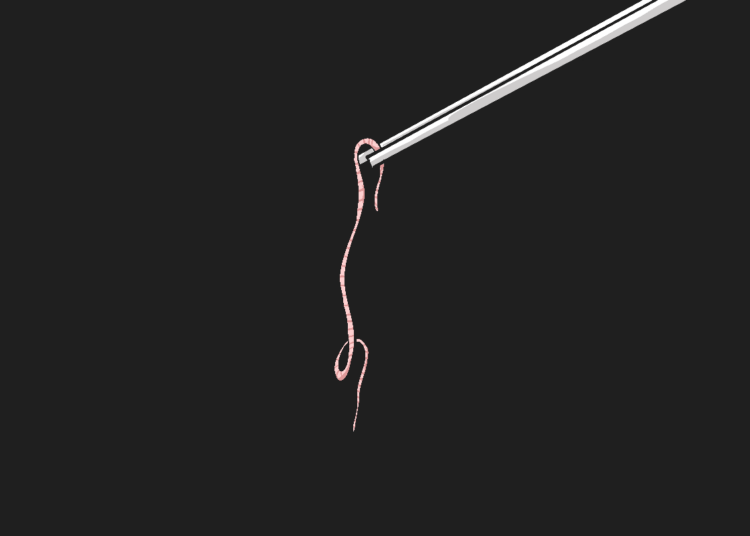 Raya, bocah asal Sukabumi yang meninggal karena cacing gelang. Sempat ditolong rumah teduh. MOJOK.CO