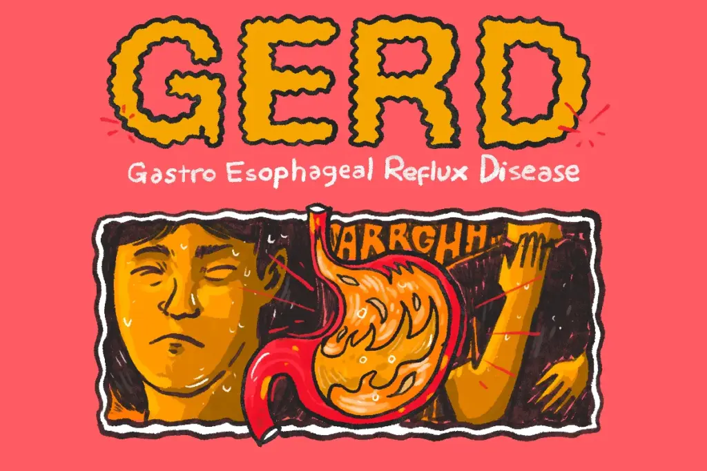 Kerja di Pabrik, Kuliah S2, dan Dihajar Asam Lambung MOJOK.CO