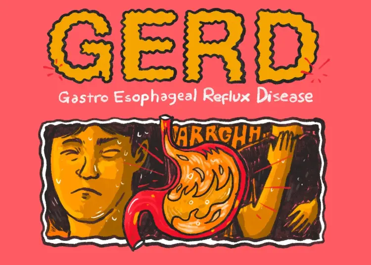 Kerja di Pabrik, Kuliah S2, dan Dihajar Asam Lambung MOJOK.CO