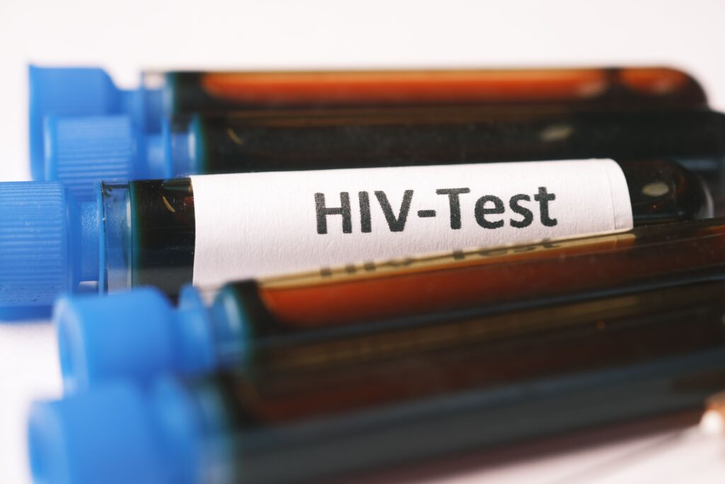 Ratusan anak di Sidoarjo terpapar HIV AIDS dan pentingnya periksa kesehatan sebelum menikah MOJOK.CO