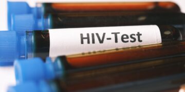 Ratusan anak di Sidoarjo terpapar HIV AIDS dan pentingnya periksa kesehatan sebelum menikah MOJOK.CO