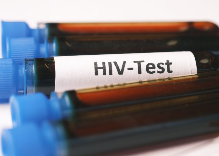 Ratusan anak di Sidoarjo terpapar HIV AIDS dan pentingnya periksa kesehatan sebelum menikah MOJOK.CO